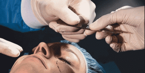 کوچک کردن بینی با جراحی