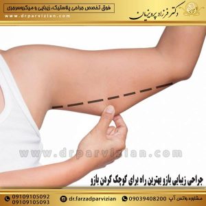 جراحی زیبایی بازو بهترین راه برای کوچک کردن بازو